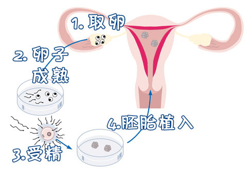 培养室